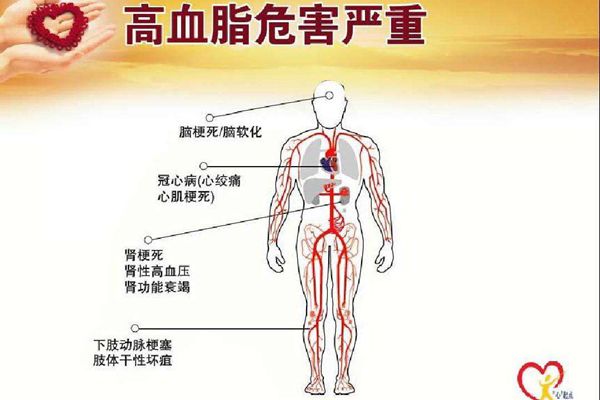 藏紅花降血脂嗎 藏紅花降血脂怎么吃